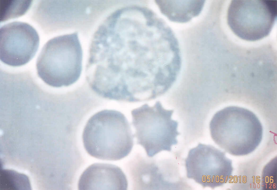 Blood sample 40x Phase contrast - Macrophage