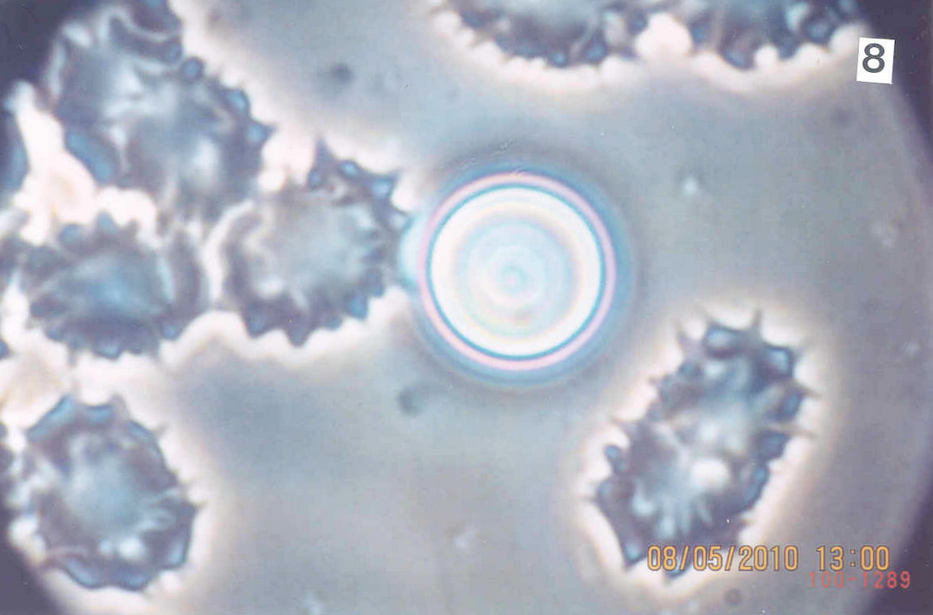 Blood sample 40x Phase contrast - Acanthocyte intracellular infection