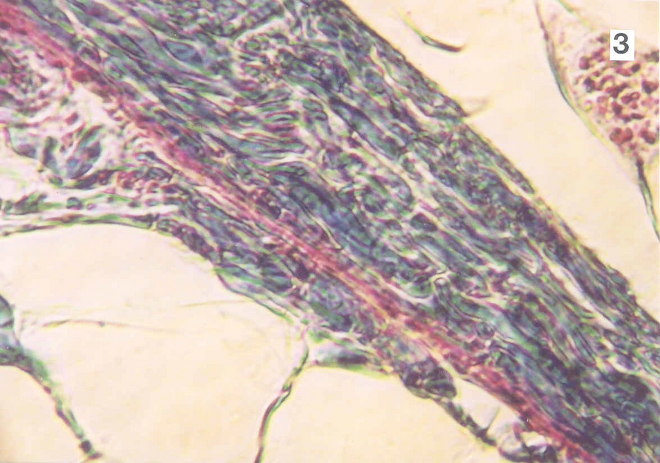 Tissue sample - 20x Phase contrast